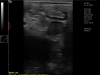 Dramiński 4vet slim portable escaner de ultrasonido gato pancreas duodeno