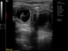 Dramiński 4vet slim ultrasonograf weterynaryjny kot ciąża