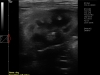Dramiński 4vet slim veterinary ultrasound scanner dog left kidney
