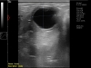 Dramiński 4vet slim portable ultrasound scanner for equine ovary