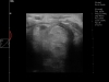 Dramiński Blue sportpferd becken ultraschall scan