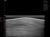 Dramiński Blue ultrasonografia układu ruchu konia