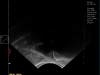 Dramiński Blue ultrasonografia konia sportowego sonda P probe