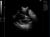 dog-echocardiogram-ultrasound-examination-right-parasternal-long-axis-view