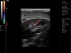 dog-kidney-ultrasound-examination-doppler