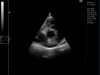 dog-ultrasound-examination-echocardiogram-la-ao-vi-probe