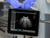 Einfache Untersuchung von Patienten in Quarantäne mit dem Ultraschallgerät DRAMINSKI BLUE