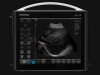 Lightweight DRAMINSKI BLUE ultrasound scanner with very high image quality