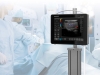 Escáner de ultrasonido moderno y ligero para los departamentos de emergencia de los hospitales