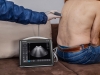Escáner de ultrasonido Dramiński BLUE para examinar pacientes en el campo