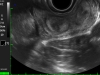 diagnostisches Bild der Gebärmutterhörner einer Kuh, Sonografie
