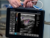Lightweight ultrasound device for animals