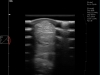 Dramiński Blue muskulo skeletal system ultrasound examination