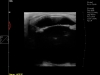 Dramiński Blue horse eye ultrasound examination