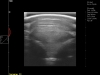 Dramiński Blue horse tendon ultrasound scan