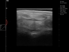 Dramiński Blue ultrasound examination of horse tendon