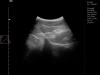 Dramiński Blue ultrasound examination of horse forelimb