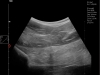 Dramiński Blue ultrasound examination of horse hindlimb