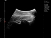 Dramiński Blue horse pelvis ultrasound examination