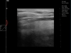 Dramiński Blue ultrasound examination of sport horse