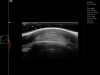 Dramiński Blue portable ultrasound scanner sport horse examination