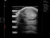 Dramiński Blue ultrasound scanner for sport horse locomotive tract