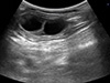 Diagnostyka ultrasonograficzna jajników u bydła