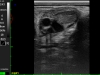 Vaca – ovario con folículos y cuerpos lúteos - examen con la sonda rectal lineal