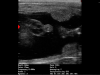 iscan-mini-innere-organe-des-maennlichen-foetus