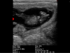 iscan-mini-foetus