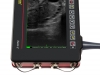 Ultrasound diagnostics with a 7” screen
