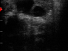 Draminski-iScan-mini-cow-ovary
