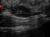 Draminski-iScan-mini-cow-uterus-and-ovaries